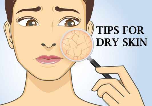 5 Tips for Dry Skin - Sheamakery Skincare